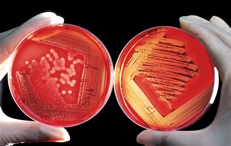 listeria vibrio top list  deadliest foodborne pathogens  outbreak