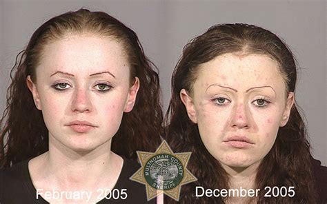 Pics Shocking Before And After Snap Pictures Show The Ravaging Impact