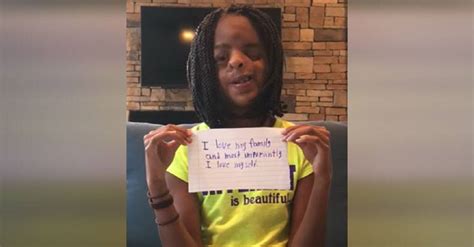 11 year old with major birth defect reminds everyone that different is