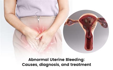 Abnormal Uterine Bleeding Causes Diagnosis And Treatment