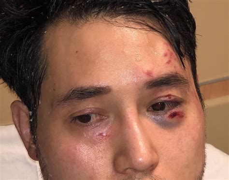 antifa s brutal assault on andy ngo is a wake up call—for authorities and journalists alike