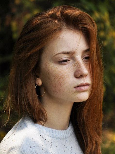 Freckle Friday Dump Album On Imgur Freckles Postures Trending Memes