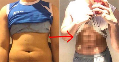 Asian Man Undergoes Shocking Plastic Surgery To Get Killer Abs