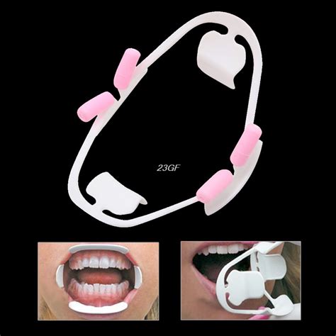 oral dental mouth opener intraoral cheek lip retractor prop adult jun29