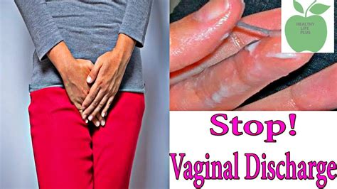 Causes Of Vaginal Discharge And Vaginal Itching Vulva And Vaginal