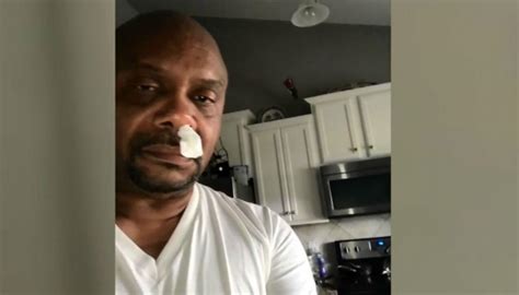 Us Man S Runny Nose Turns Out To Be Brain Fluid Newshub