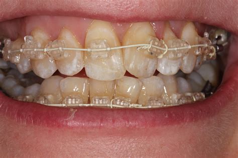 Blog Dunmurry Dental Practice