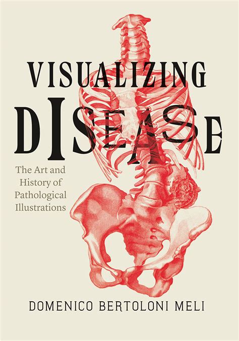 visualizing disease  art  history  pathological illustrations bertoloni meli