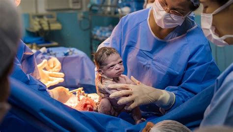 photographer captures moment newborn baby  doctors  death stare
