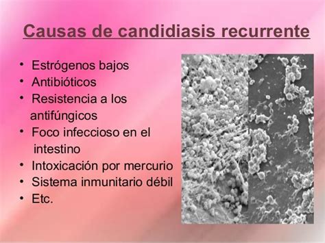 Candida Is A Parasite Cronica Natural Tratamiento Genital