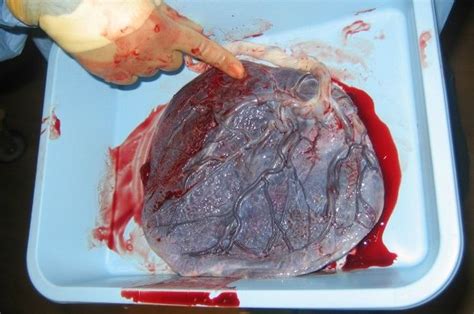 Husband Eats His Wife S Placenta Says It S Definitely Better Cooked