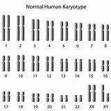 Gene Expression Karyotype Disorders Human Chromosomal Epigenetics Study sketch template