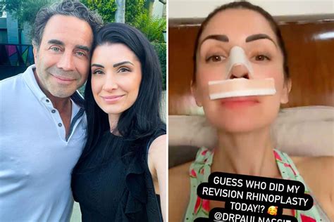 Botched S Dr Paul Nassif Gives His Own Wife Brittany A Nose Job And She
