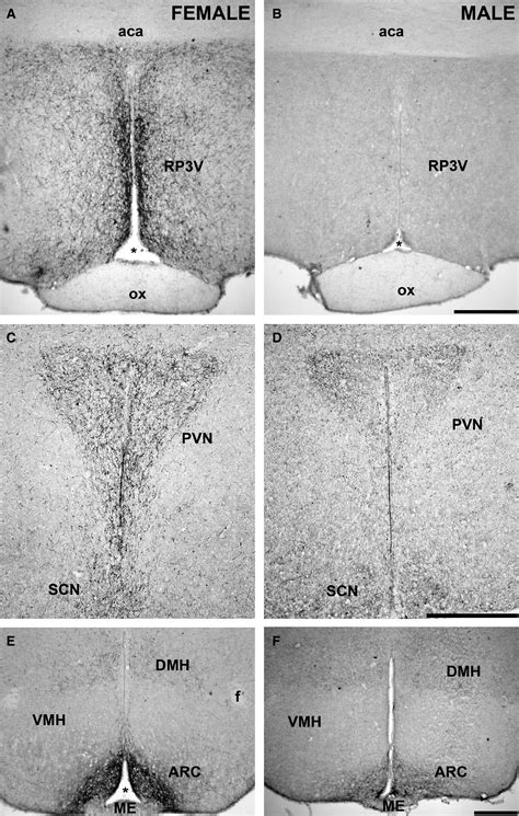 kisspeptin innervation of the hypothalamic paraventricular