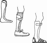 Brace Leg Clip Braces Plastic Clipground Hesperian School Children sketch template