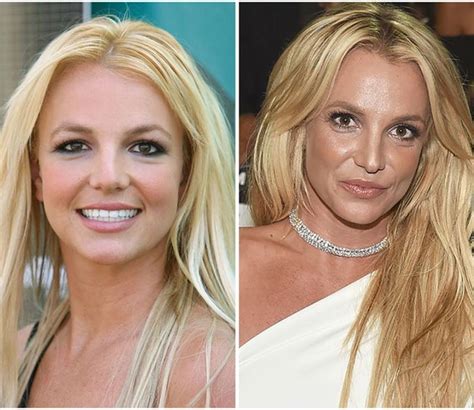 Britney Spears Before And After Plastic Surgery Reveals Her Popstar