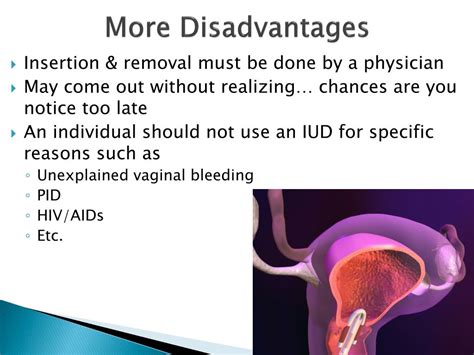 ppt intrauterine devices powerpoint presentation free download id