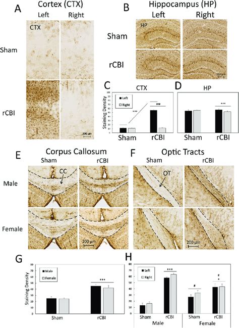 astrogliosis as observed by gfap staining following