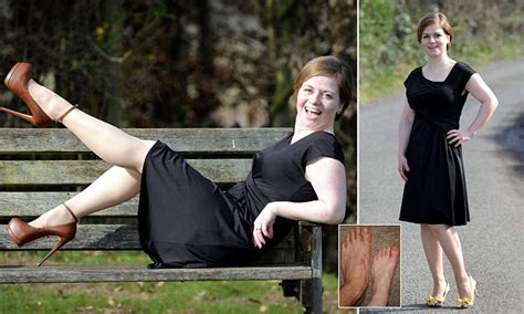 woman 36 with tiny size two feet who found it impossible to walk in heels daily mail online