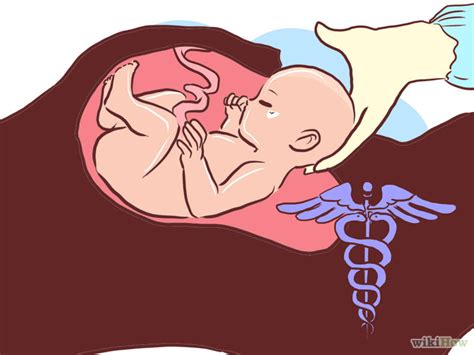 La Obstetricia Y Su Importancia