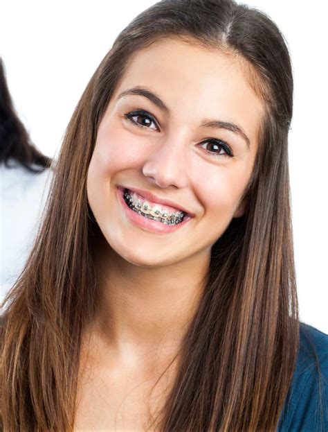 Adult Braces Everything You Need To Know Fact Education