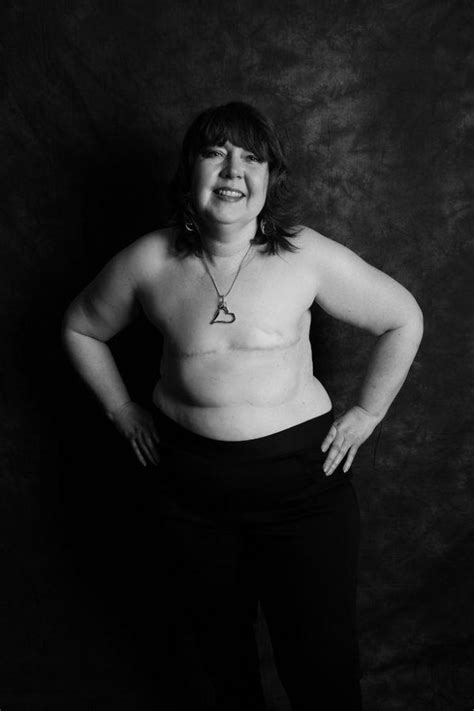 Fotos 14 Valientes Mujeres Decidieron Mostrar Su Cuerpo Sin Pechos