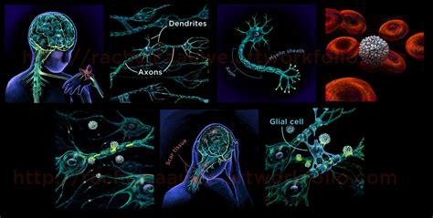 multiple sclerosis medical illustration  banvivirie  deviantart
