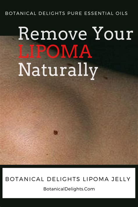 remove  lipoma naturally   cysts fatty essential oil blends