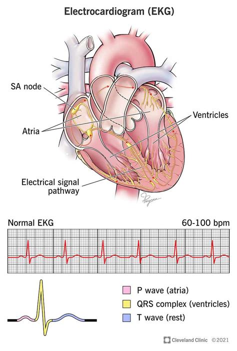Electrocardiogram Ekg Ecg