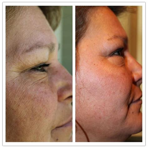 anti aging breakthrough released august of 2011 my friend angie on day