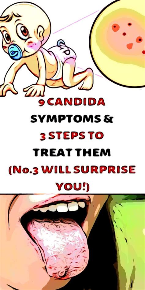 9 Candida Symptoms And 3 Steps To Treat Them
