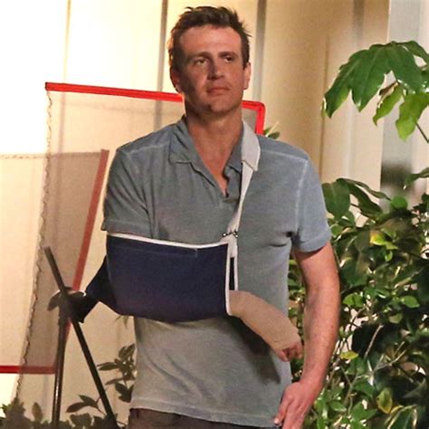 Jason Segel Looks All Banged Up On Set—see The Pic E Online