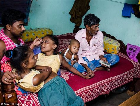 Indian Conjoined Twins 45 Find Love With The Same Man