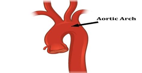 aortic arch assignment point