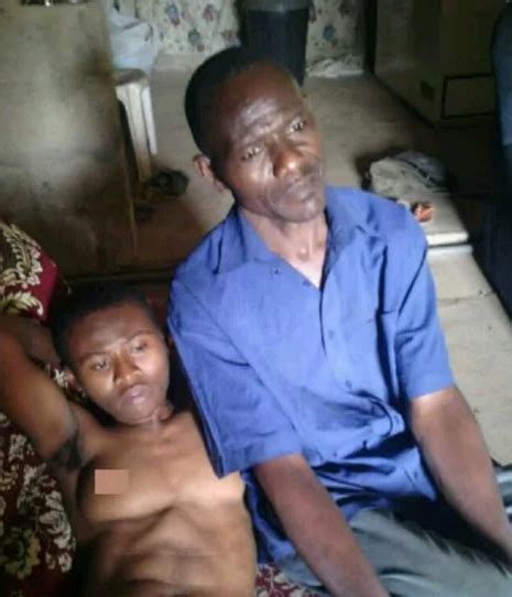 Photos Nigerian Born With Male And Female Organs Needs Help