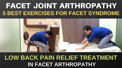 facet joint arthropathy  ll  facet joint pain relief exercises facet arthropathy