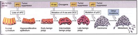 9 Progression Of Accumuations Of Mutations That Lead To Colorectal