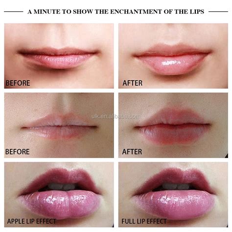 medium oval automatic electric lip thicker pump plumper enhancer for