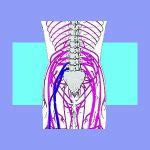 nerve root impingement sciatica