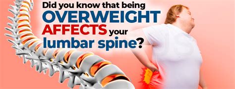 Did You Know That Being Overweight Affects Your Lumbar Spine Cordus