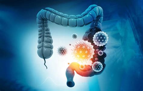 understanding leaky gut syndrome  irritable bowel