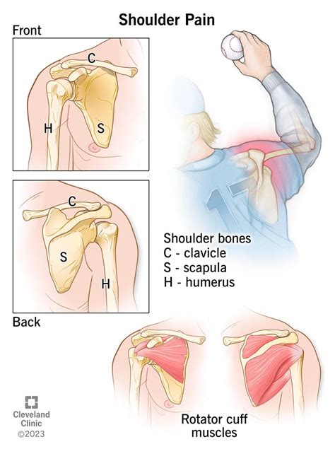 shoulder pain  treatment
