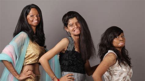 indian acid attack victims bravely star  empowering photoshoot huffpost uk life