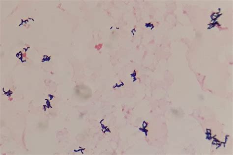 Coryneform Bacilli Bacteria Also Known As Diphtheroids