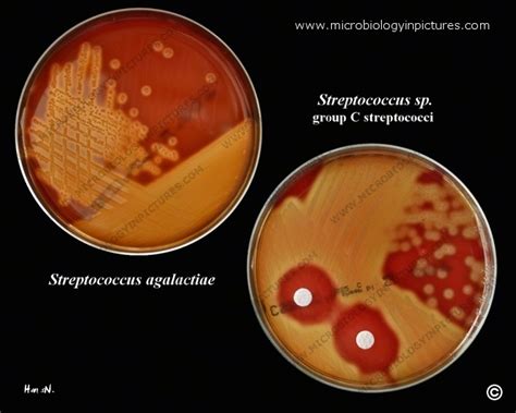 Examen Streptococcus Agalactiae Cultivo Shop Discount Save 54