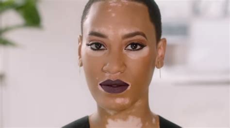 covergirl campaign features model with vitiligo for first time the independent
