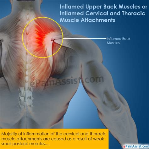 Inflammation Of Shoulder Moving To Leg Mature Video Sites