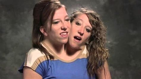 Conjoined Twins Abby And Brittany Hensel Get Own Reality