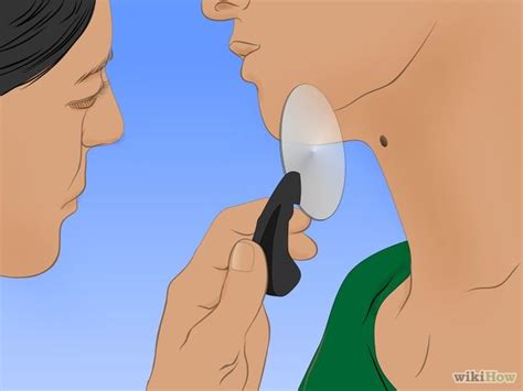 how to remove moles without surgery 13 steps with pictures