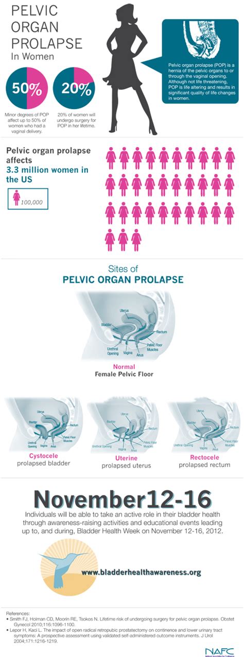 Pelvic Organ Prolapse Visual Ly